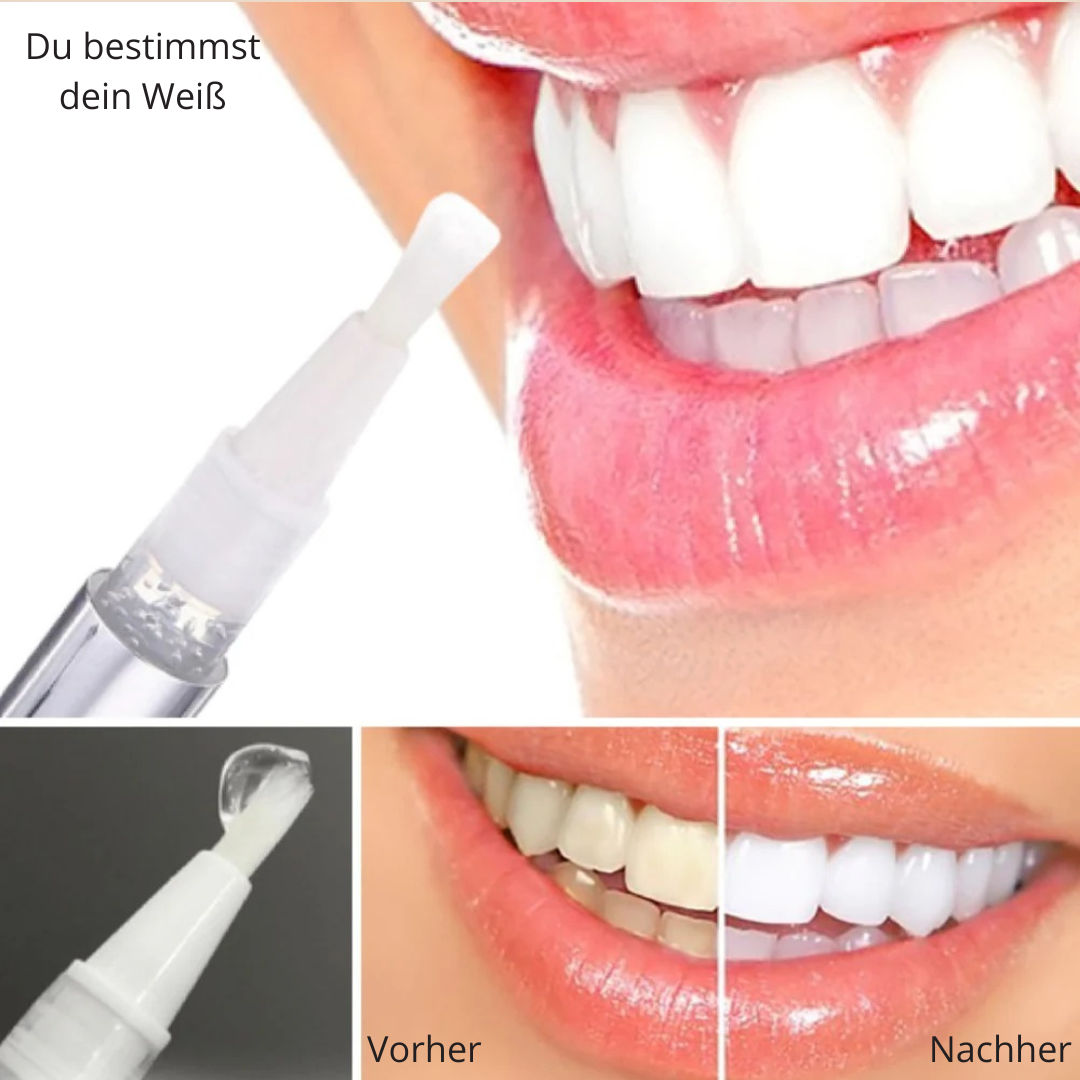 JetSmile – Dein Weg zu weißen Zähnen