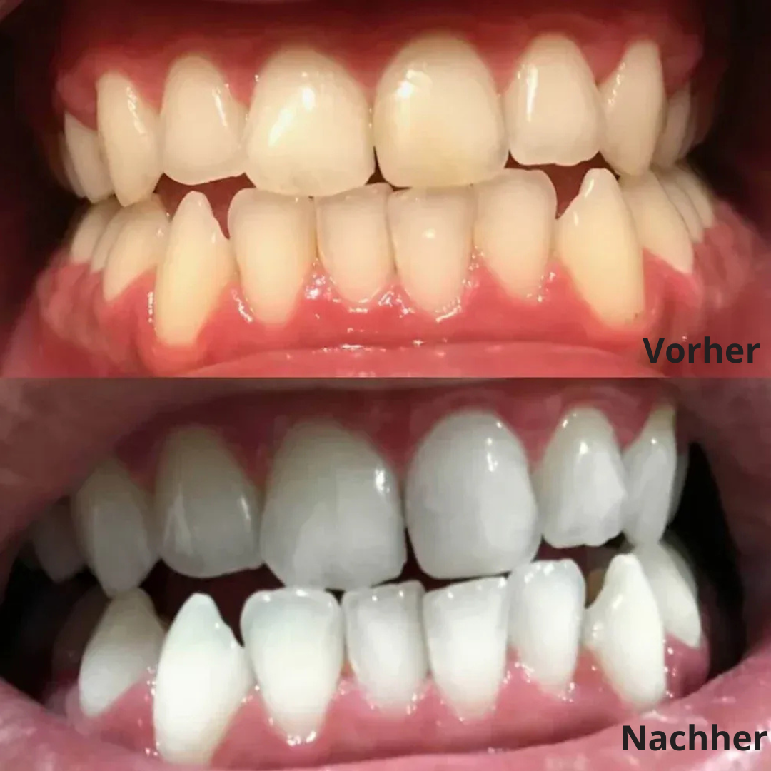 JetSmile – Dein Weg zu weißen Zähnen