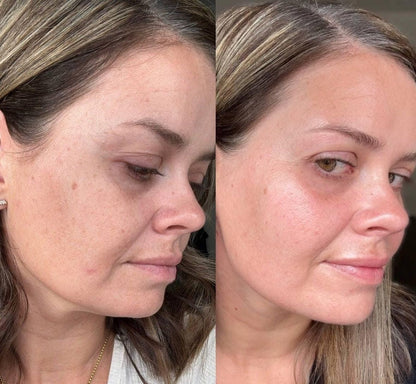 Retinal Shot & Retinol Shot – Gegen Falten, Augenringe & Tränensäcke