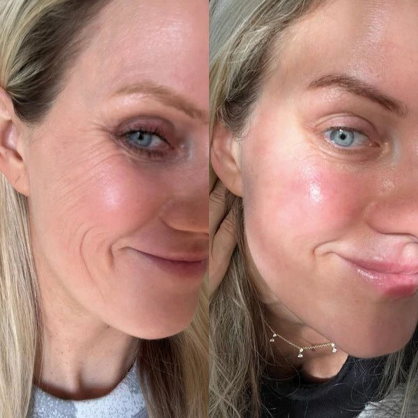 Retinal Shot & Retinol Shot – Gegen Falten, Augenringe & Tränensäcke