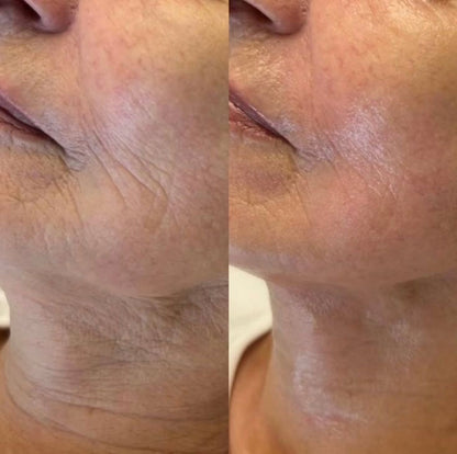 Retinal Shot & Retinol Shot – Gegen Falten, Augenringe & Tränensäcke