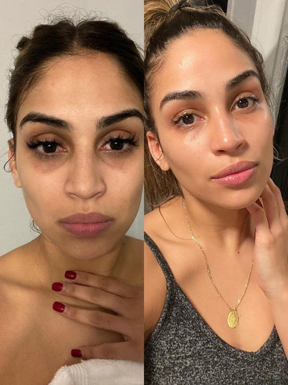 Retinal Shot & Retinol Shot – Gegen Falten, Augenringe & Tränensäcke